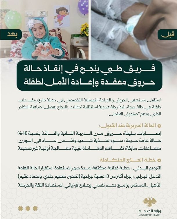 فريق طبي ينجح في إنقاذ حالة حروق معقدة وإعادة الأمل لطفلة